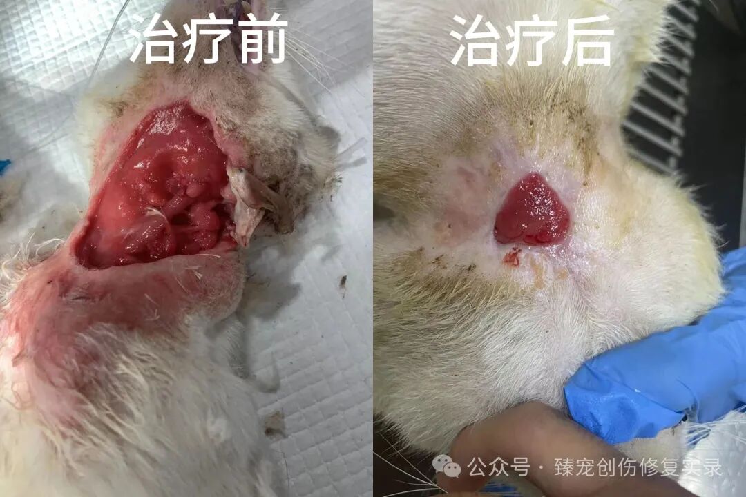 颈部缝合后形成空腔？外泌体如何25天创造愈合奇迹